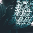 Alzheimer-Medikament fehlt bis Jahresende Symbolbild: Arzt sichtet Gehirn-Scans