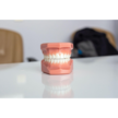 Zahnzusatzversicherungen: Sinnvoll oder unnötig?