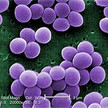 Microvionin: Neues MRSA-Antibiotikum entdeckt Microvionin: Neues MRSA-Antibiotikum entdeckt