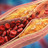 Neuer Wirkstoff gegen LDL-Cholesterin Neuer Wirkstoff gegen LDL-Cholesterin