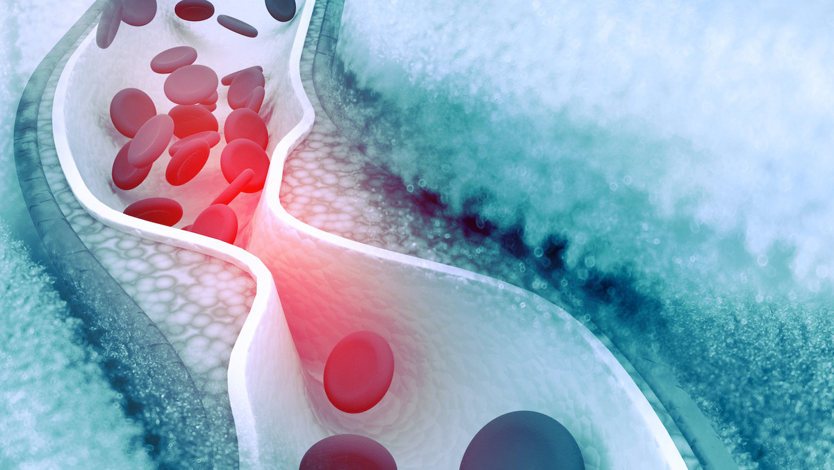 Cholesterol: Between HDL & LDL