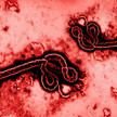 Ebola-Patienten: Symptome bessern sich Ebolavirus unter dem Mikroskop