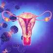Endometriose: Spielen Fusobakterien eine Rolle? Endometriose: Spielen Fusobakterien eine Rolle?