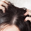 Psoriasis: Neue Hilfe für die Kopfhaut Psoriasis: Neue Hilfe für die Kopfhaut