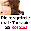 ROSAZEA – die richtige Beratung für das unterschätzte Hautleiden