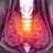 Levothyroxin: Schilddrüsenmittel einfach absetzen? Levothyroxin: Schilddrüsenmittel einfach absetzen?