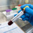 WHO zu Ebola: „Wir hinken hinterher!“ WHO zu Ebola: „Wir hinken hinterher!“