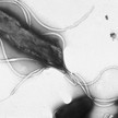 Helicobacter pylori Wikipedia Helicobacter: Pathomechanismus entschlüsselt
